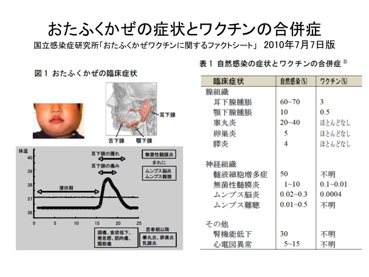 おたふくかぜ2014年-08